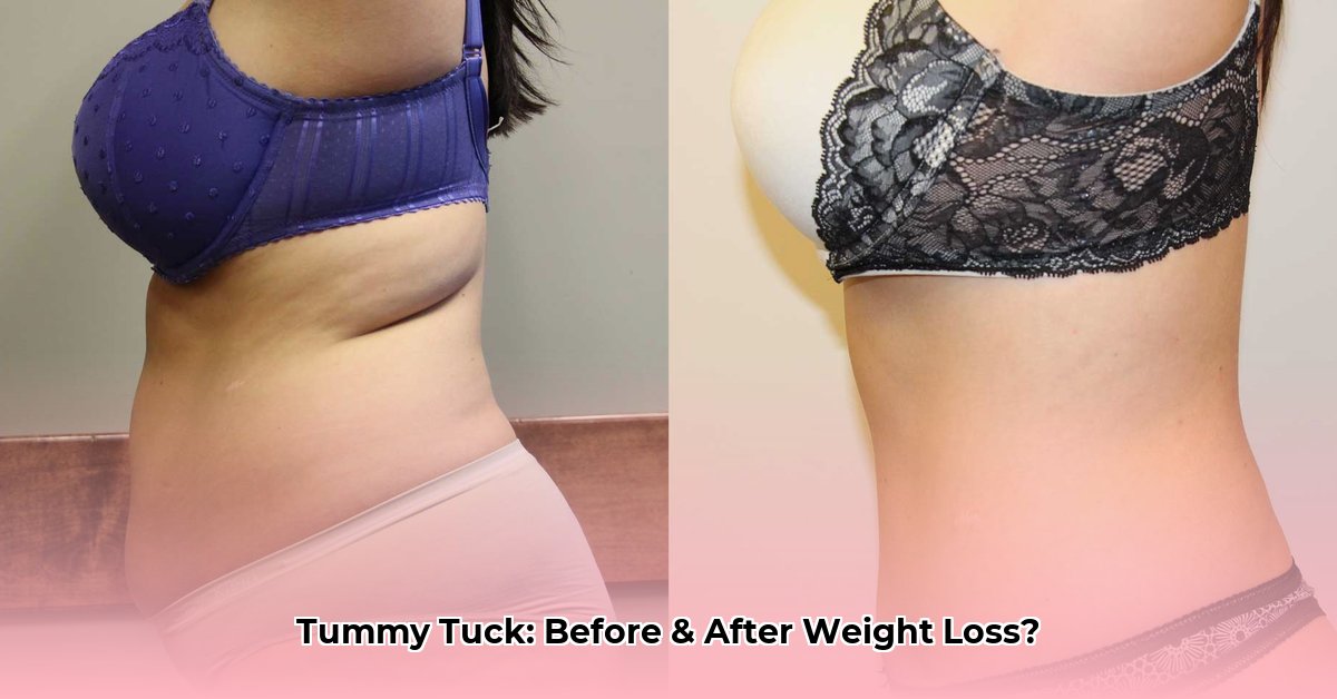 tummy-tuck-before-and-after-weight-loss